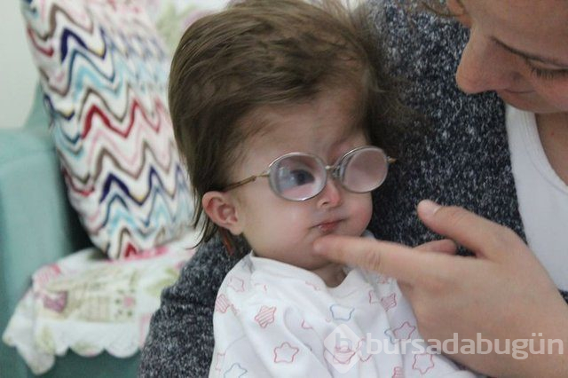 2 yaşındaki Hallerman-Streiff Sendromlu minik Hira yardım bekliyor!
