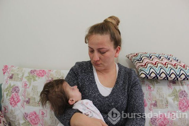 2 yaşındaki Hallerman-Streiff Sendromlu minik Hira yardım bekliyor!
