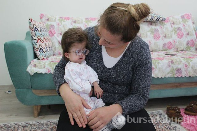 2 yaşındaki Hallerman-Streiff Sendromlu minik Hira yardım bekliyor!
