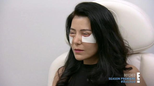 Manken Nuray daha genç görünmek isterken kendini bir kabusun içinde buldu
