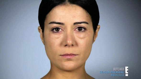 Manken Nuray daha genç görünmek isterken kendini bir kabusun içinde buldu
