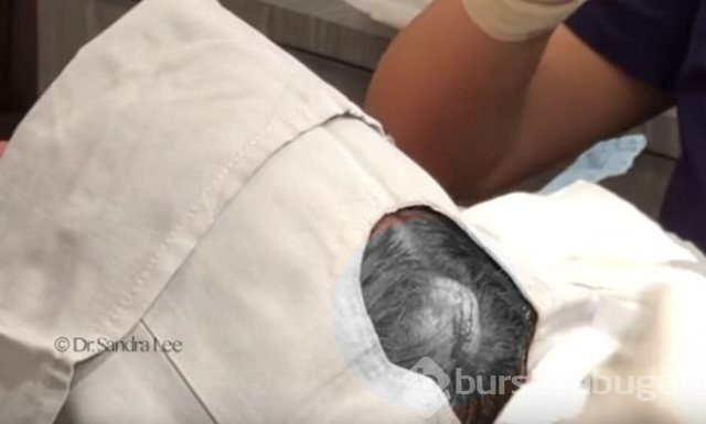 Kulaklarını deldirdi, hayatı kabusa döndü!
