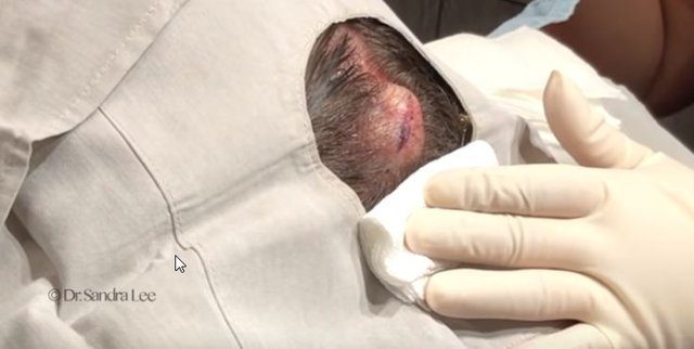 Kulaklarını deldirdi, hayatı kabusa döndü!
