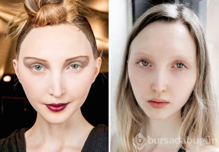 Görme engelli model (Kusurlarıyla mükemmelliğe meydan okuyan süper modeller)