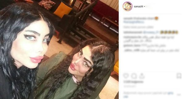 İran'ın 'estetikli kadınları'
