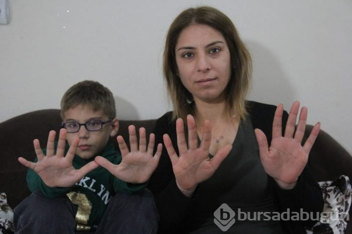 6 parmaklı Demirhan ne yazı yazabiliyor, ne ayakkabı bulabiliyor
