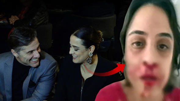 Bu görüntüler olay olmuştu... Barıştılar!
