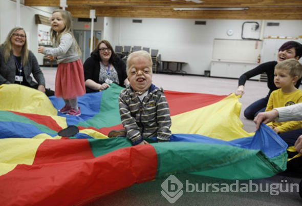 Dünyada sadece 30 kişide rastlanıyor!
