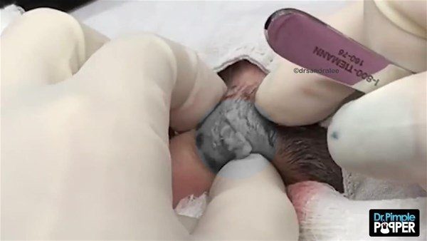 Fenomen doktordan yine çok konuşulan operasyon
