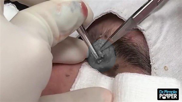 Fenomen doktordan yine çok konuşulan operasyon
