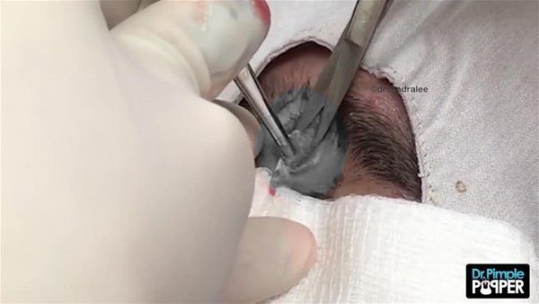 Fenomen doktordan yine çok konuşulan operasyon
