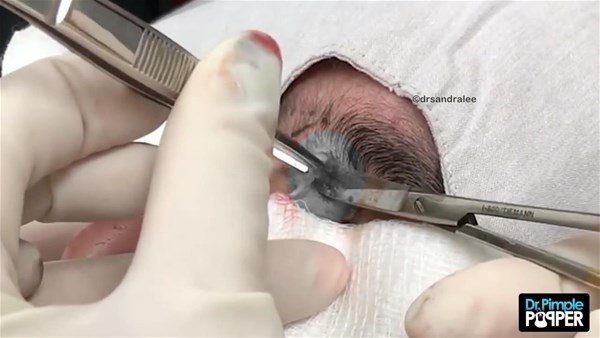 Fenomen doktordan yine çok konuşulan operasyon
