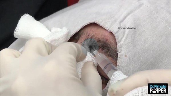 Fenomen doktordan yine çok konuşulan operasyon
