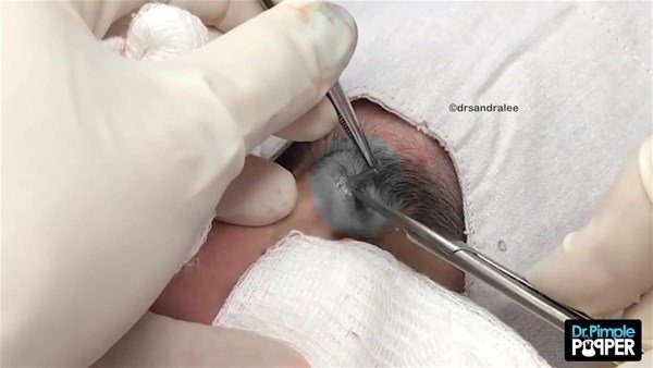 Fenomen doktordan yine çok konuşulan operasyon
