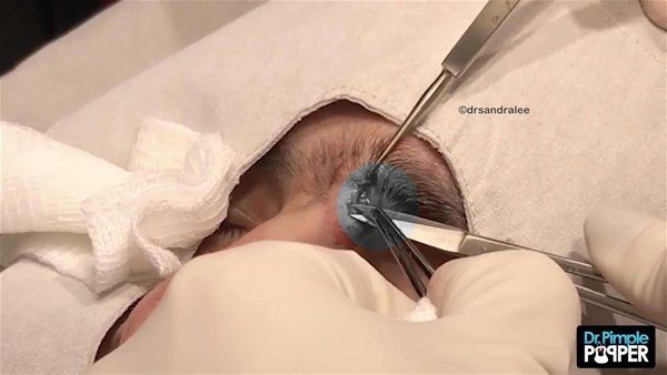 Fenomen doktordan yine çok konuşulan operasyon
