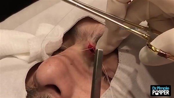 Fenomen doktordan yine çok konuşulan operasyon
