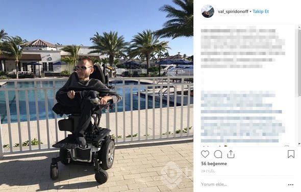 Kafa nakli gönüllüsünün yeni hayatı

