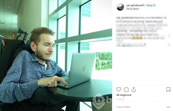 Kafa nakli gönüllüsünün yeni hayatı
