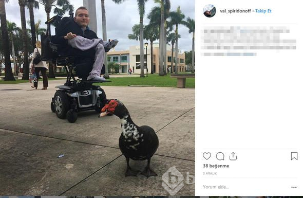 Kafa nakli gönüllüsünün yeni hayatı

