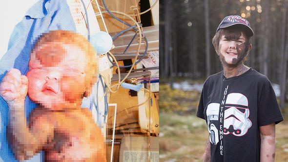 50 binde bir görülen hastalığa yakalandı
