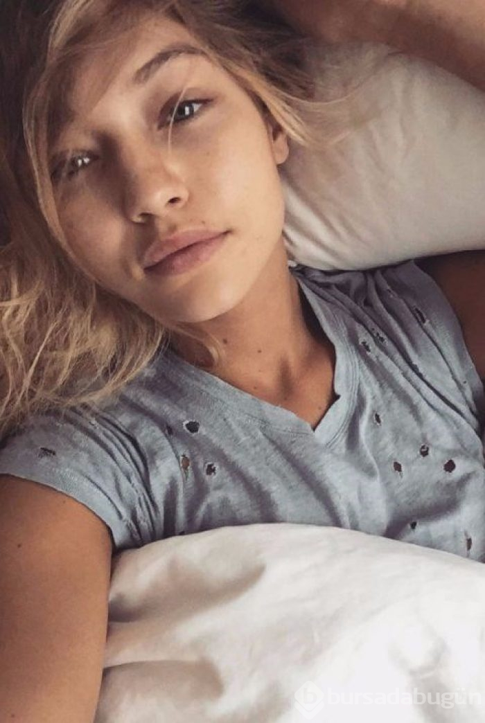 Taylor Hill'den sivilceli paylaşım (Victoria's Secret meleklerinin makyajsız halleri)