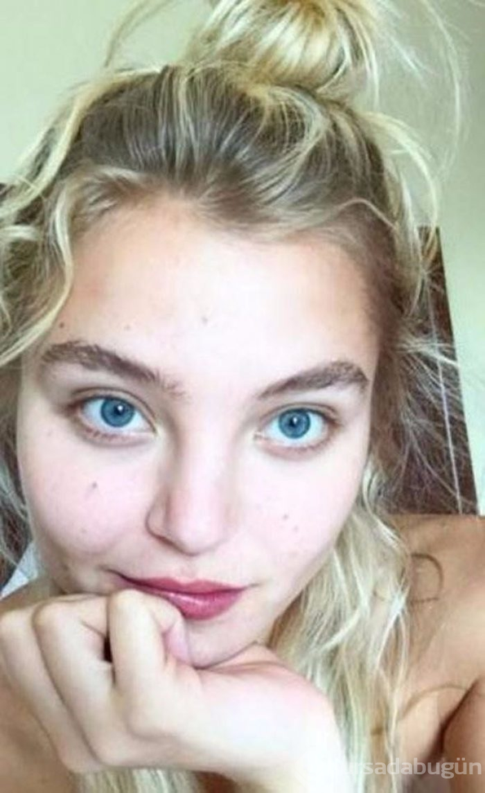 Taylor Hill'den sivilceli paylaşım (Victoria's Secret meleklerinin makyajsız halleri)