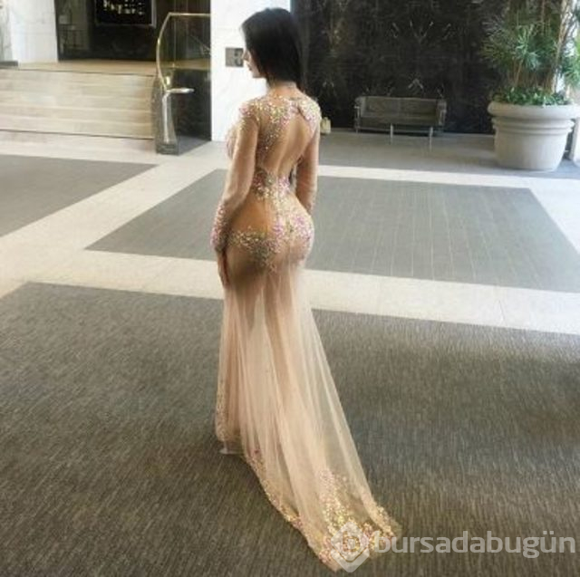 Kim Kardashian gibi görünmek için kalçasına 2,5 kilo yağ enjekte ettirdi
