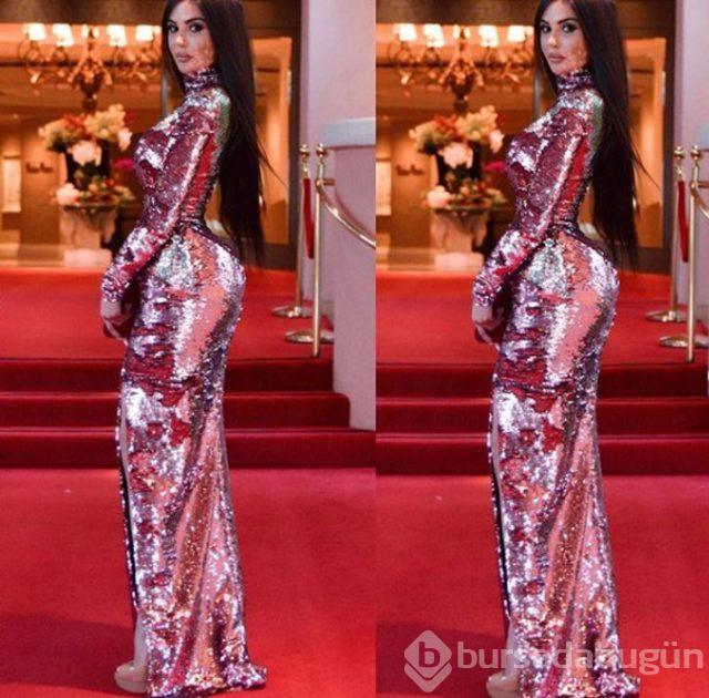 Kim Kardashian gibi görünmek için kalçasına 2,5 kilo yağ enjekte ettirdi
