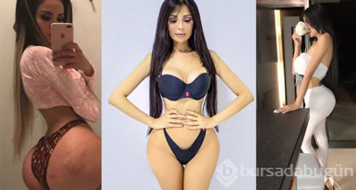Kim Kardashian gibi görünmek için kalçasına 2,5 kilo yağ enjekte ettirdi
