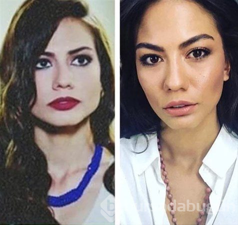 Ünlülerin estetik karnesi
