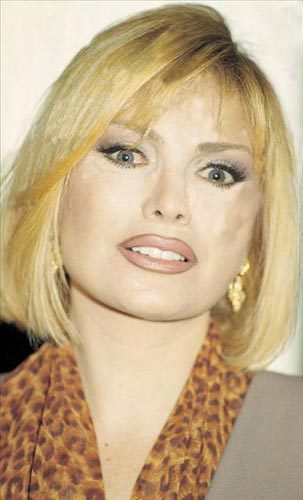 Ünlülerin estetik karnesi
