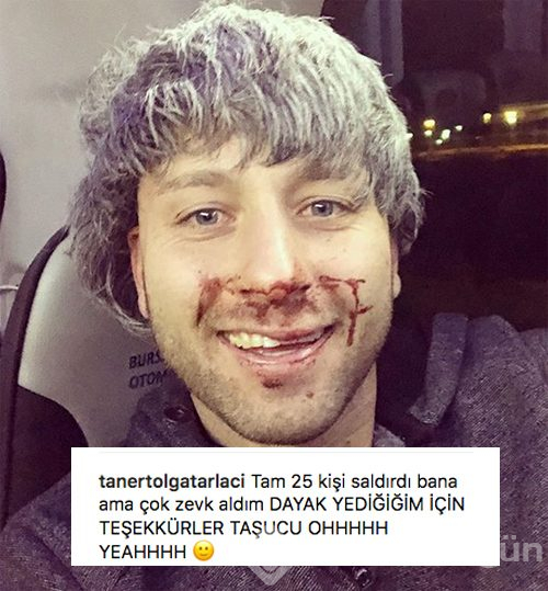 Survivor Taner Tarlacı dayak sonrası görüntüleri ve yazdıkları olay oludu
