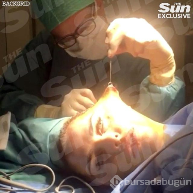 Ünlü isim yüz germe ameliyatının videosunu paylaştı