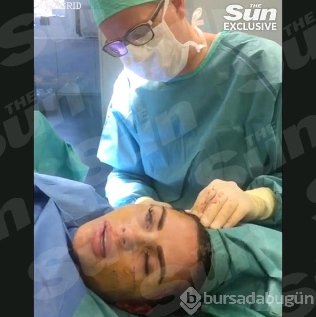 Ünlü isim yüz germe ameliyatının videosunu paylaştı