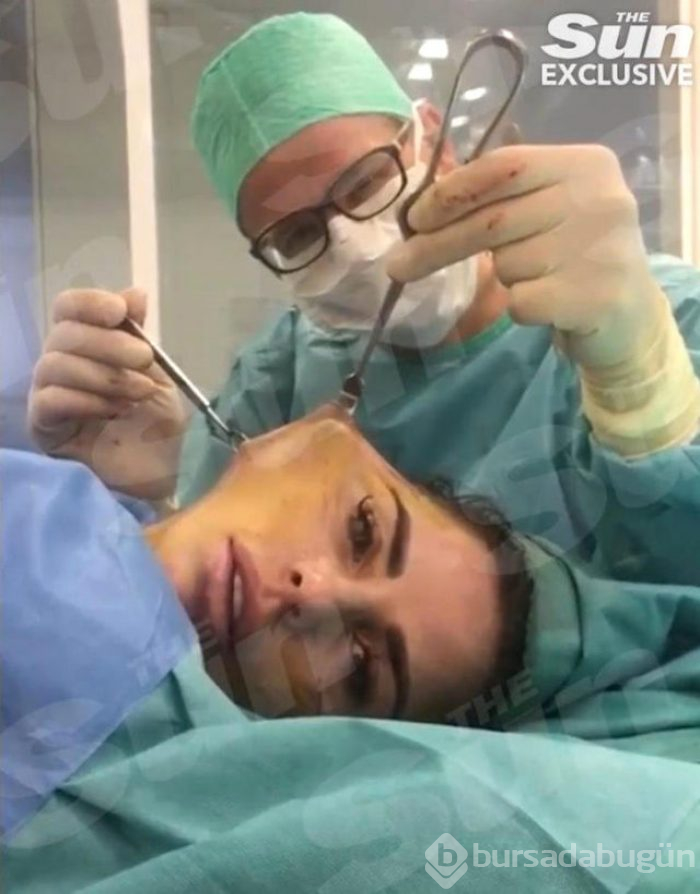 Ünlü isim yüz germe ameliyatının videosunu paylaştı