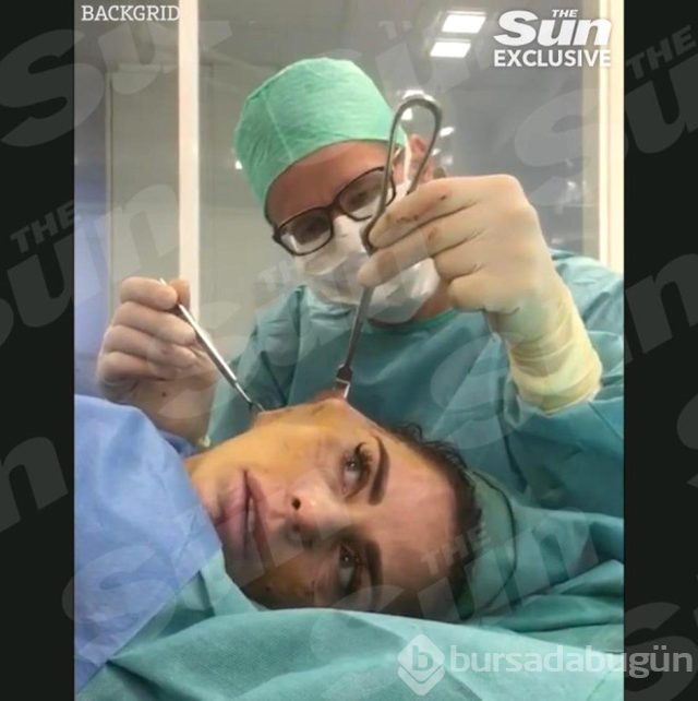 Ünlü isim yüz germe ameliyatının videosunu paylaştı