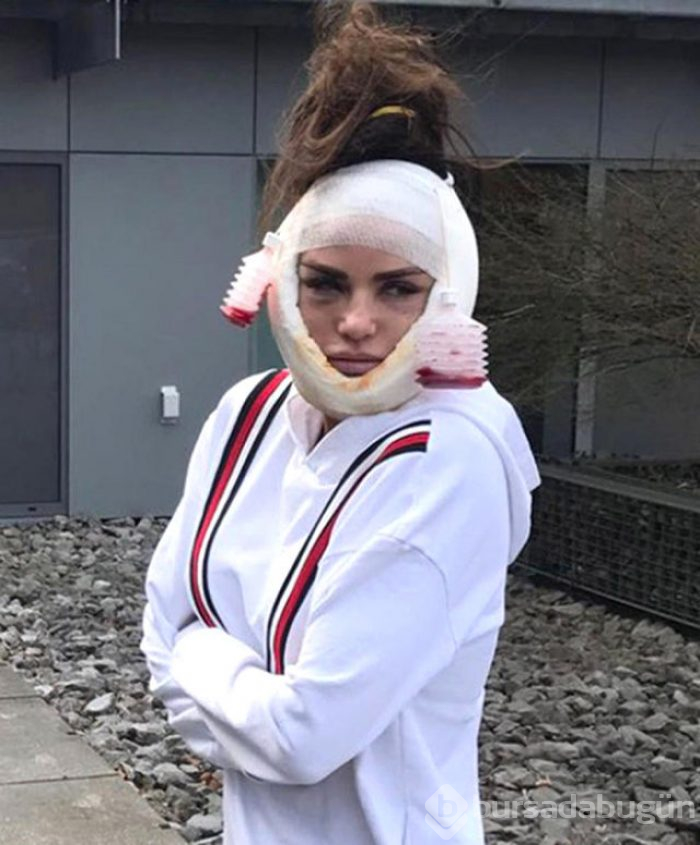 Ünlü isim yüz germe ameliyatının videosunu paylaştı