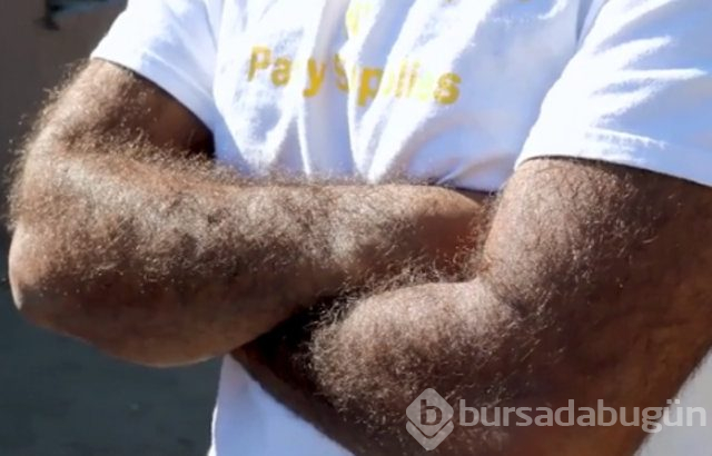 Kurt adam lakaplı Larry Gomez'in vücudunun yüzde 98'i kıllarla kaplı
