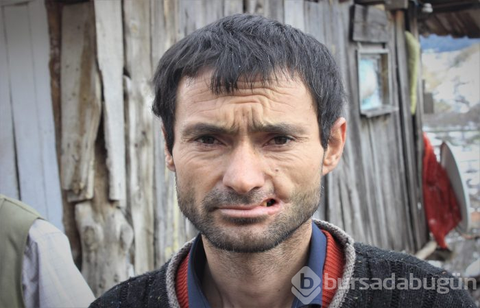 Eşeği yanağını parçaladı! Tek isteği estetik ameliyat olmak
