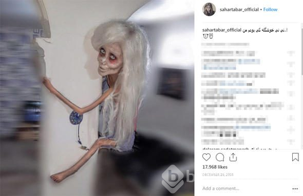 "Boynum kırıldı" dedi sonra da bunu yaptı
