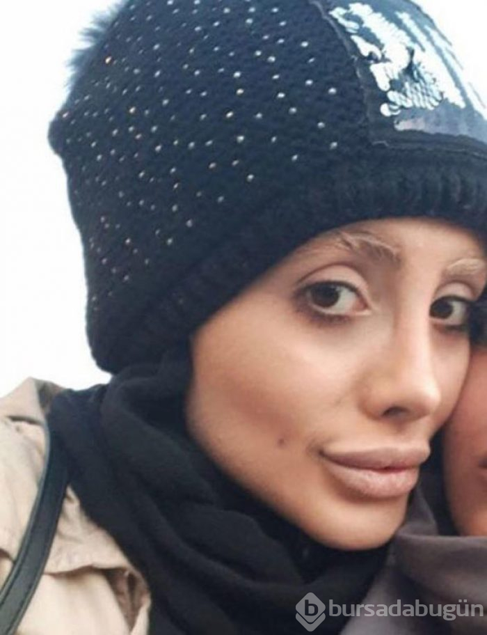 "Boynum kırıldı" dedi sonra da bunu yaptı

