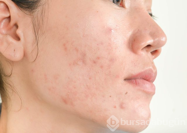 Dermatologların kara listeye eklediği 7 güzellik ürünü
