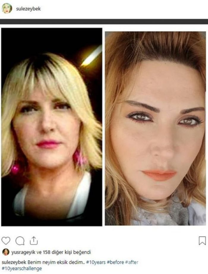Ünlülerin 10 yıl önce 10 yıl sonra akımı