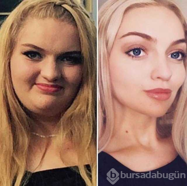 Diyet ve egzersiz yaparak 78 kilo verdi
