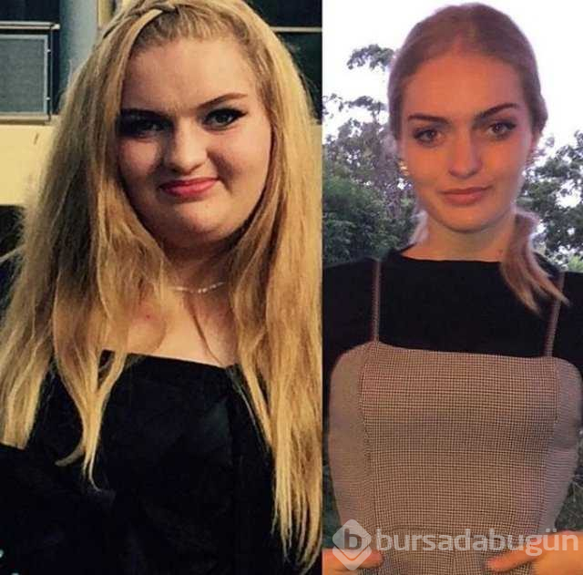 Diyet ve egzersiz yaparak 78 kilo verdi
