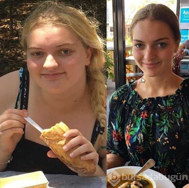 Diyet ve egzersiz yaparak 78 kilo verdi
