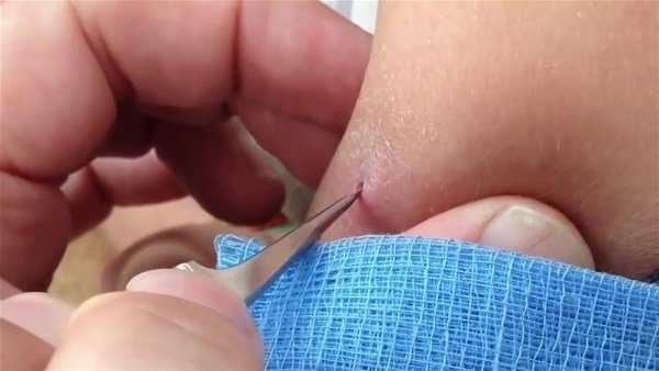 Kolundan çıkanlar şoke etti!
