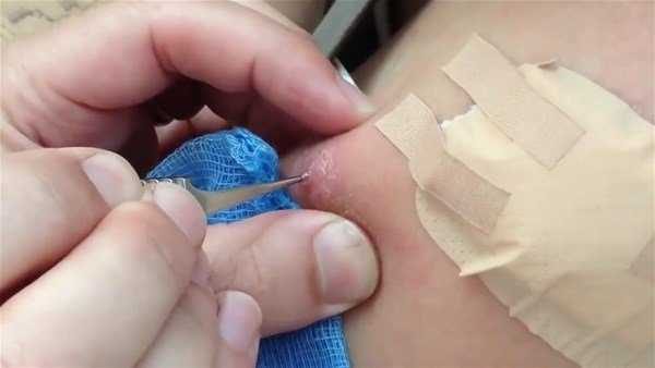 Kolundan çıkanlar şoke etti!
