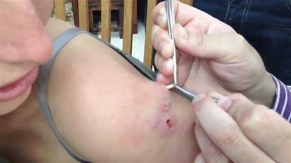 Kolundan çıkanlar şoke etti!
