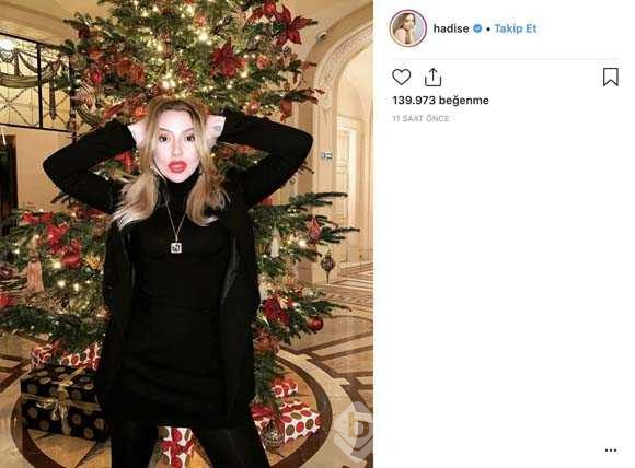 Hadise'den bomba Murat Boz paylaşımı